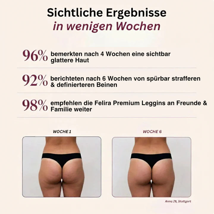 FigurPro Leggins